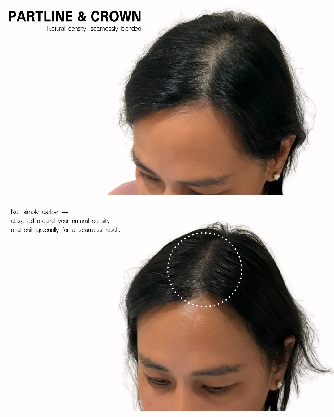 강남 논현 반영구 스튜디오 하우뷰티 HOW Beauty의 SMP 가르마 시술 사례 4